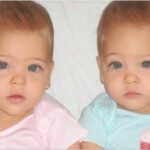 At age seven, they were recognized as the most beautiful twins in the world. What do they look like three years later?